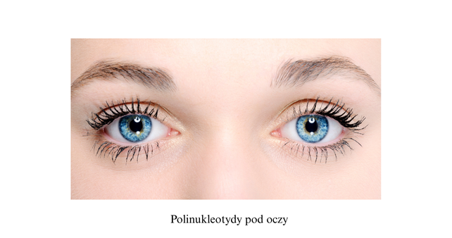 Polinukleotydy pod oczy