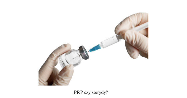 PRP czy steryd