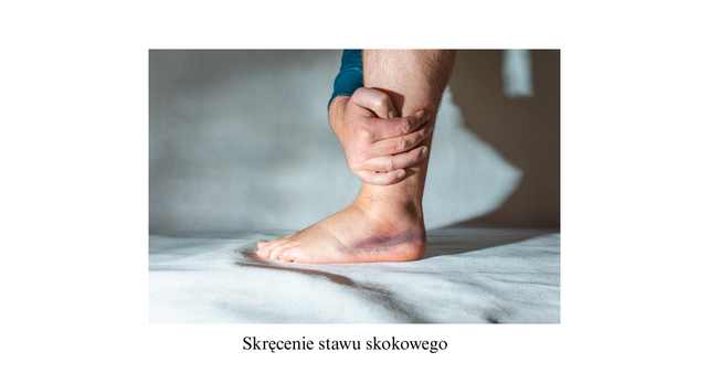 Skręcenie stawu skokowego